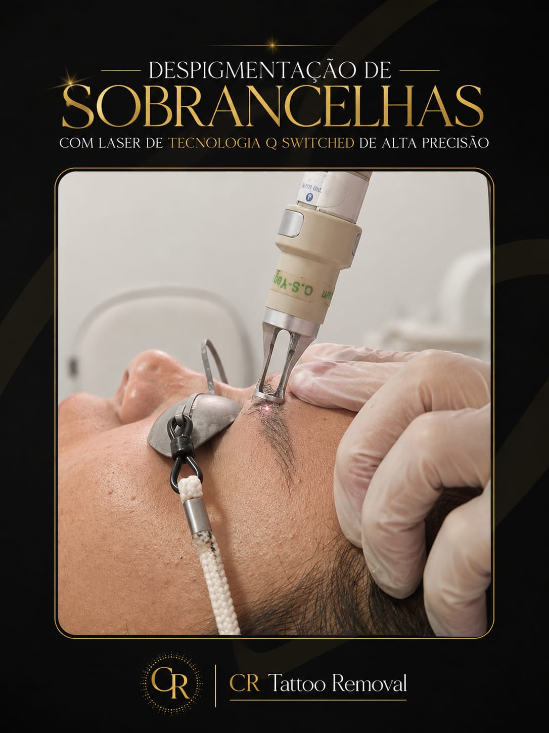 Procedimento a Laser