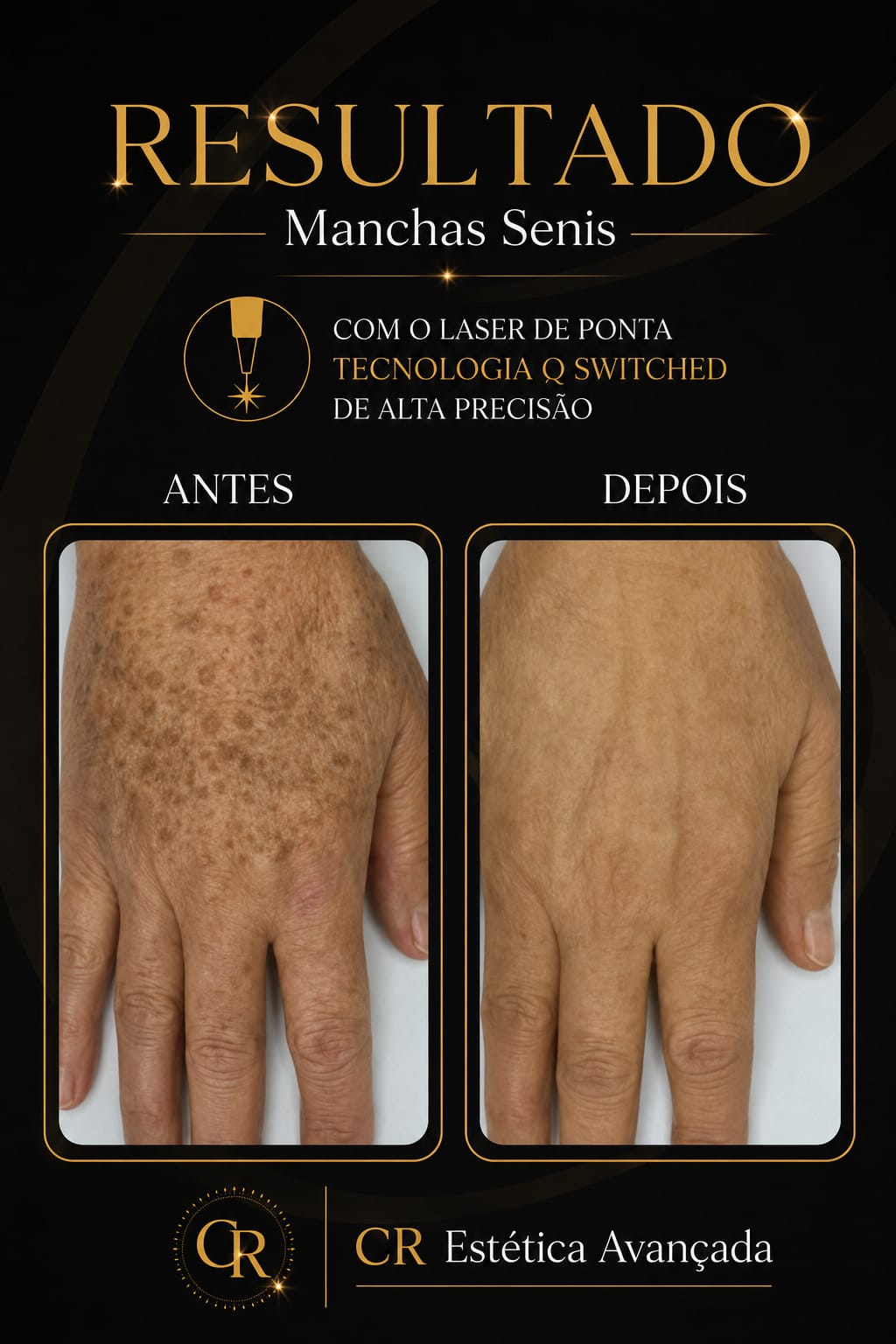 Manchas Senis